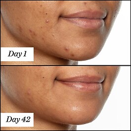 U.F.O. Ultra-Clarifying - Face Oil